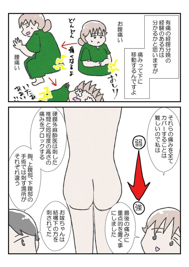 三人目の無痛分娩レポだよ⑧(2)