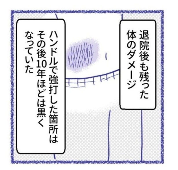 「内臓破裂メモリー」P45