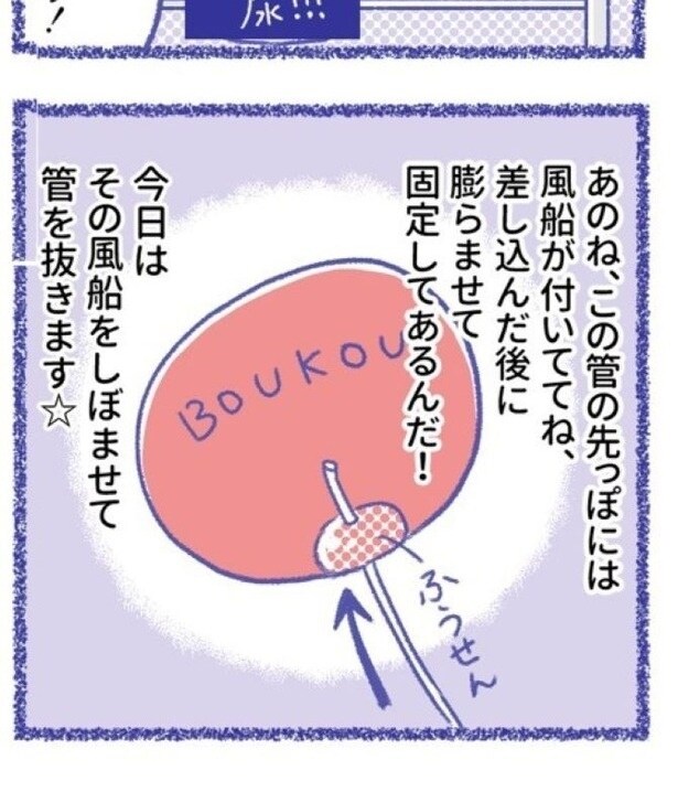 「内臓破裂メモリー」P56