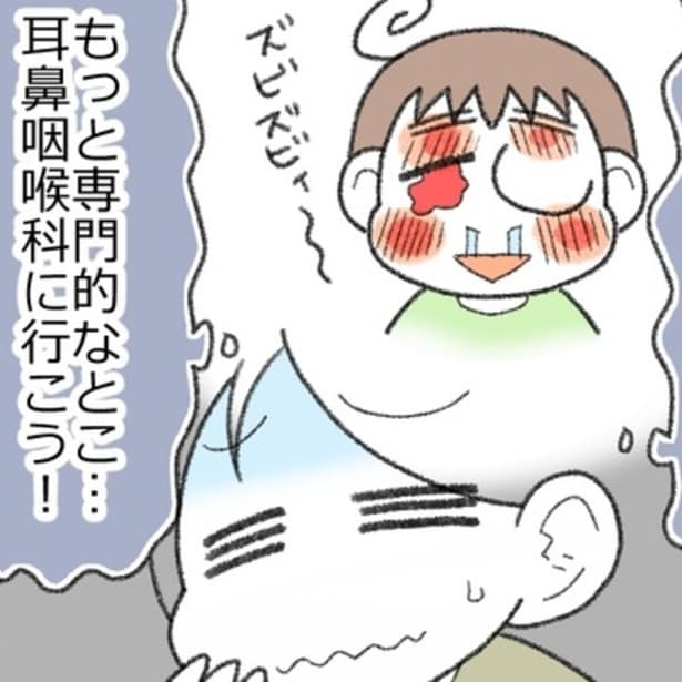 アレルギーのかゆみで顔をこすり、酷い有様になってしまった息子。自身も過去に同じような経験をしたこともあり、専門的な治療を受けさせようと決めた。