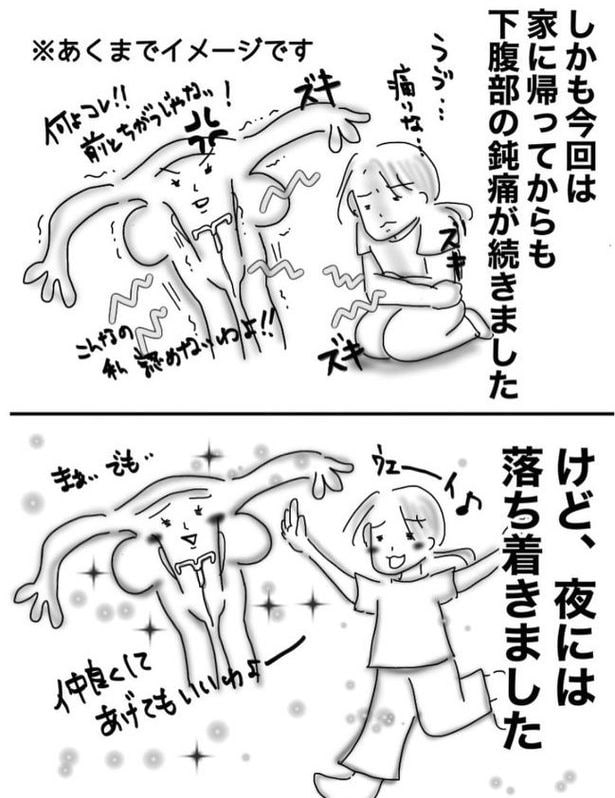 ミレーナ05