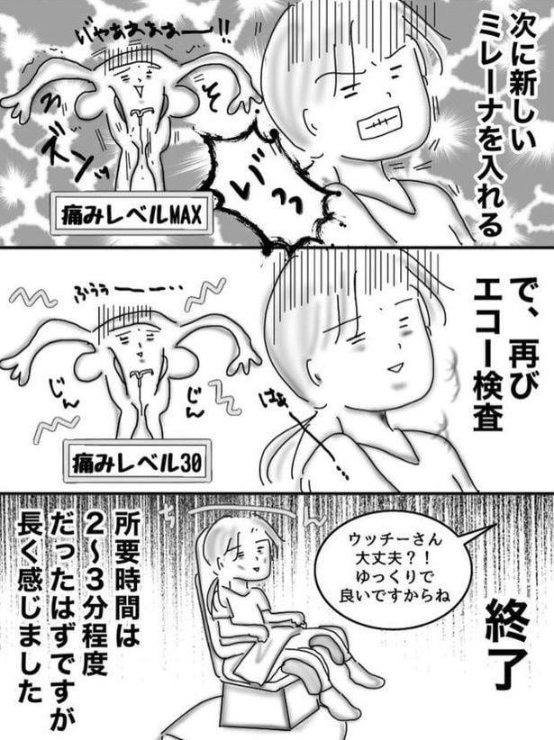 ミレーナ04