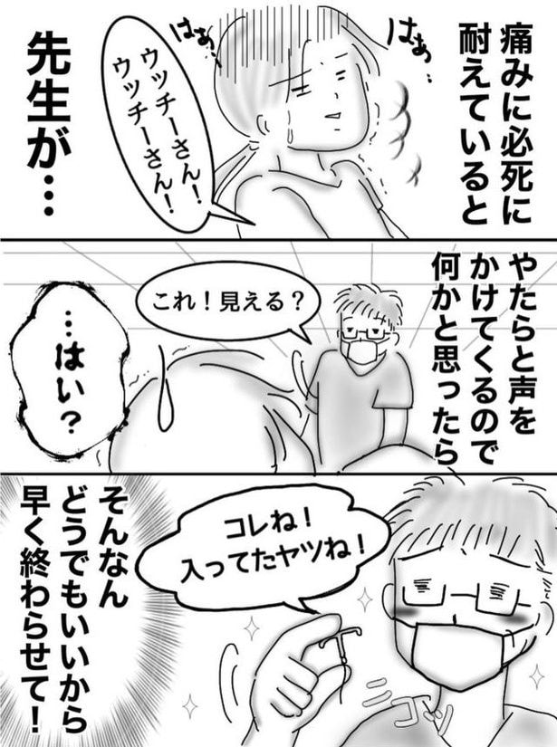 ミレーナ03