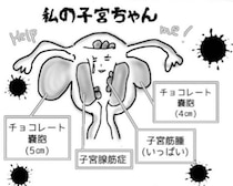 「妊娠か手術の2択」医師の過酷な宣告→実は子宮内膜症だった私、4カ月先の手術と闘病の全貌に「痛いほどわかる」【作者に聞く】
