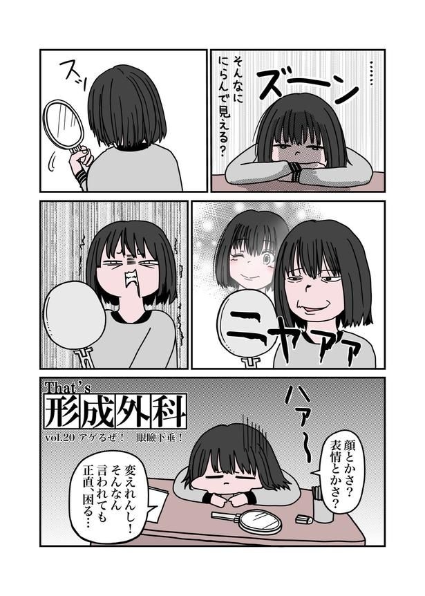 目が重たくてツラい病気『眼瞼下垂』を治したら、色々ラクになったお話03