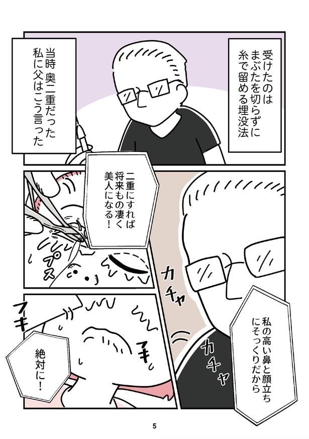 「14歳で整形した私」5