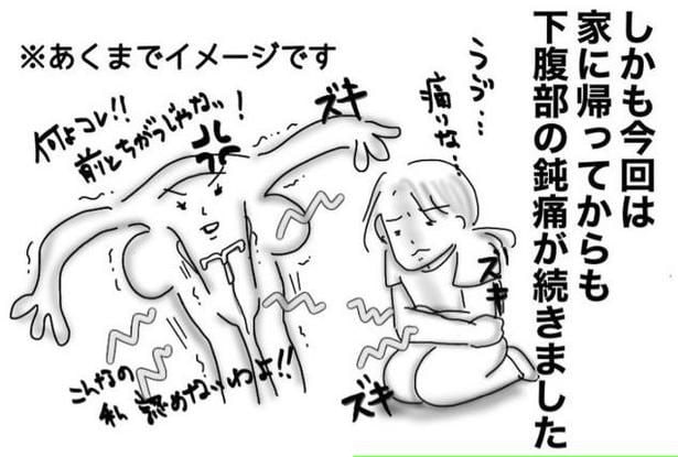 ミレーナ装着ルポ03