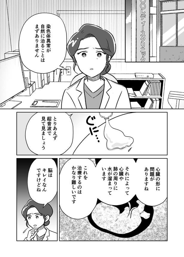 「わたしが選んだ死産の話」3話_006
