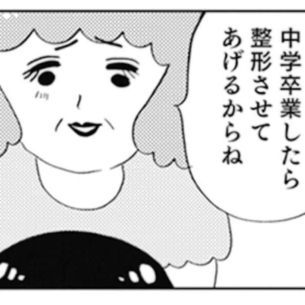 一重まぶたの娘を「かわいそうに」と憐れむ母。