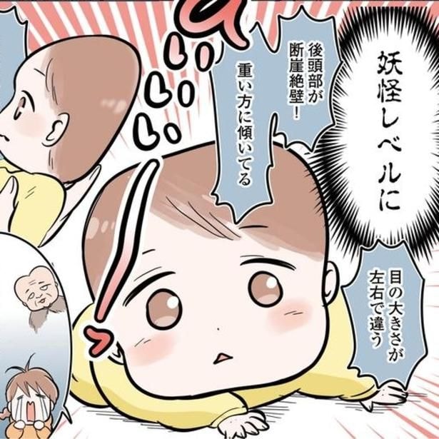ポン子の頭の形は、寝かせ方などの努力ではどうにもならない状態に!?