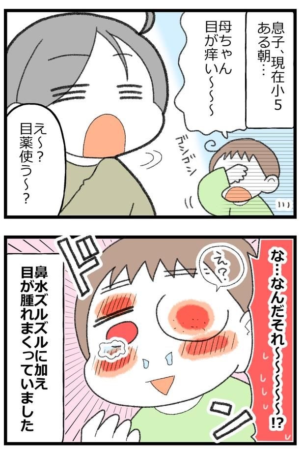 息子がアレルギーで舌下免疫療法をはじめた話2