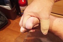 歩行困難になるほど足に激痛…　夏の“ある習慣”明かし鈴木おさむ氏「かなり原因かも」