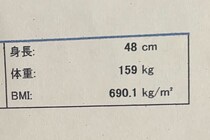 身長48cmの女性コスプレイヤー、健康診断の結果が「異次元すぎる」と話題　BMIは前人未到の690