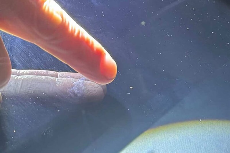 ニコニコレンタカー車の傷