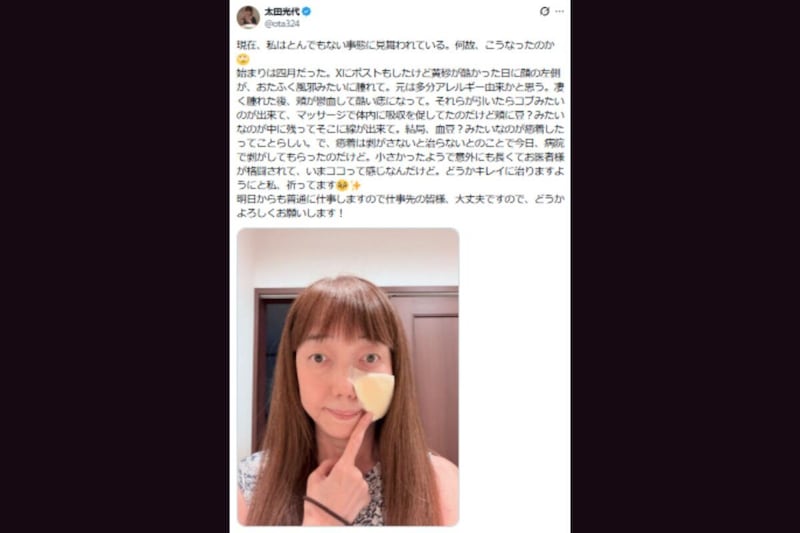 太田光代X