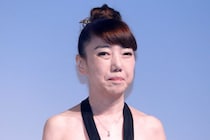 太田光代、“顔面への異変”明かす　「おたふく風邪みたいに」「病院で剥がしてもらった」