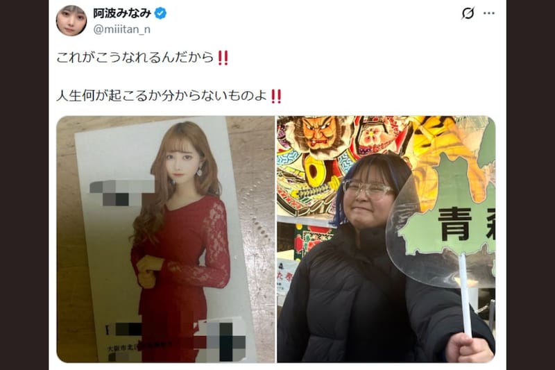 美人タレントのビフォーアフター、完成形はまさかの“そっち” 勘違いする人が続出「すごい変化」