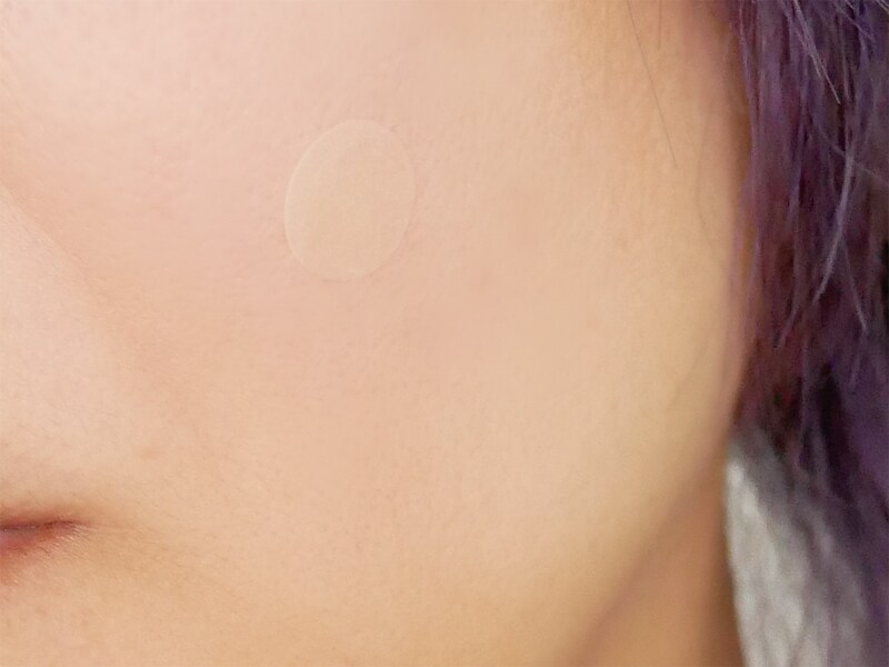 バンドエイド 顔用 ニキビパッチ 治る