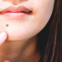 モテる女はここにある！ホクロの位置で分かる恋愛運とは