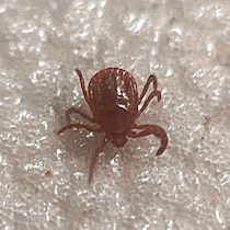 “12年で患者数4倍増”マダニ感染症SFTS「4人に1人が死ぬ」恐怖