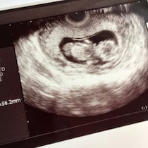 【悪質】堕胎費用を騙し取る…メルカリ「胎児エコー写真」転売禁止で「駆け込み妊娠詐欺」に気を付けろ