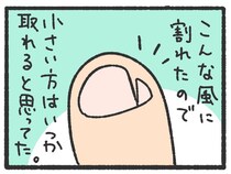 【漫画】足をぶつけて小指の爪が割れた…爪のその後が想定外！「同じです」「マジで痛い」【作者インタビュー】