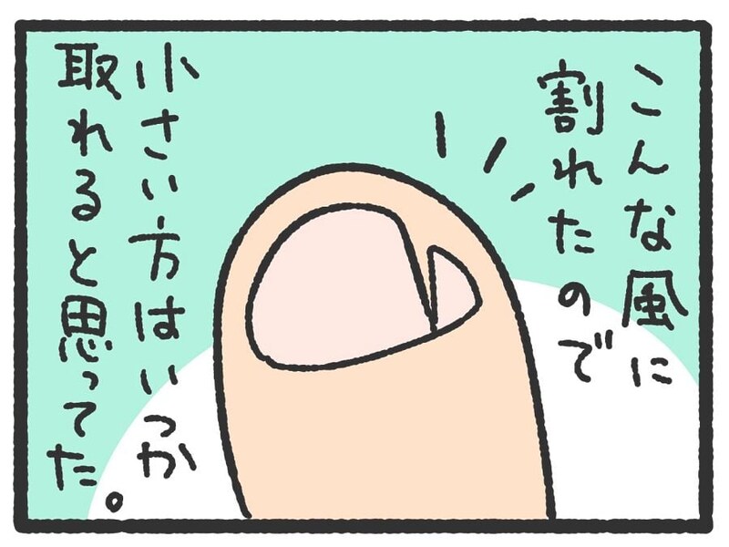 【漫画】足をぶつけて小指の爪が割れた…爪のその後が想定外！「同じです」「マジで痛い」【作者インタビュー】