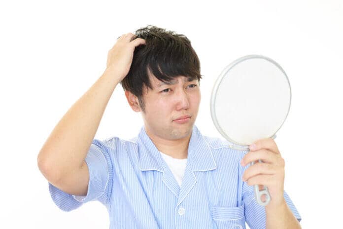 ハゲでもかっこいい人の特徴とは？
