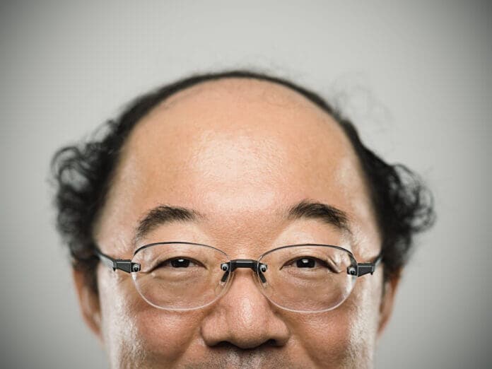 ハゲでもイケメンに見せる方法とは？