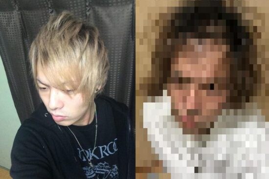 20代前半のころ「薄毛を隠していた」男性が、“隠さなくなってから”気づいたこと――仰天ニュース特報