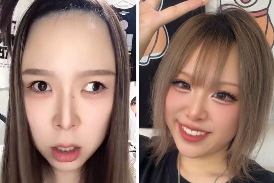 左は斜視の時で、右は斜視をコントロールしている時