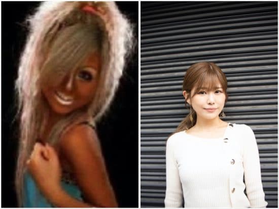 伝説の“ギャルサー”元副代表のその後。結婚、離婚、病気が発覚、選択的シングルマザーに――仰天ニュース特報