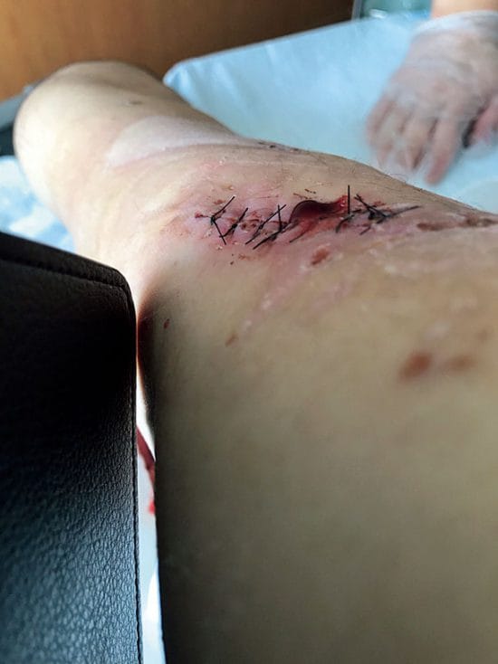 ［クマvs人間］ガチンコ撃退術