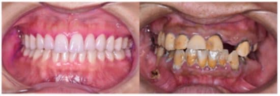 どちらの口が良いか