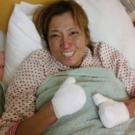 「両手足を切断しました」40歳女性を襲った病「最初は胃腸炎と診断されて…」10日間意識不明に<GW限定スペシャル>