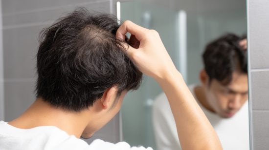 薄毛