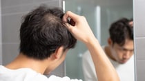 8年間女性と縁がないのはハゲのせい？ 治療するか悩む39歳男性に、佐藤優が贈る3つの選択肢