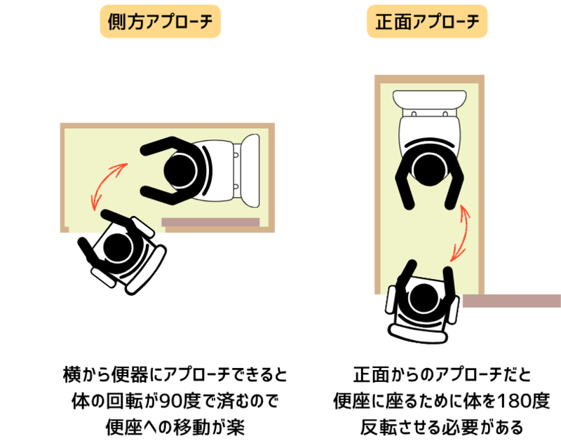 側方アプローチと正面アプローチの違い
