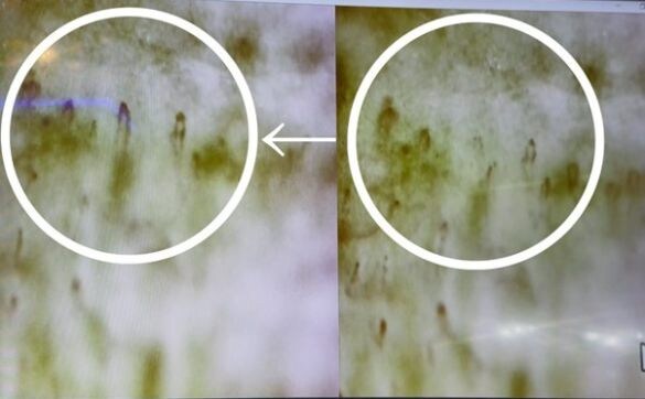 筆者の左手薬指を特殊なカメラで見たところ。全体にもやもやと緑色に映っているのが老廃物