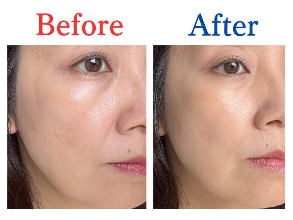 Before After エクセル エシリアル セラムコンシーラー