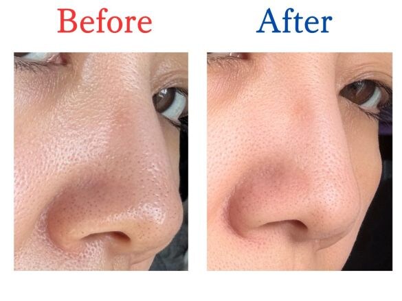 ケアナボーテ 洗顔前の毛穴づまり落とし