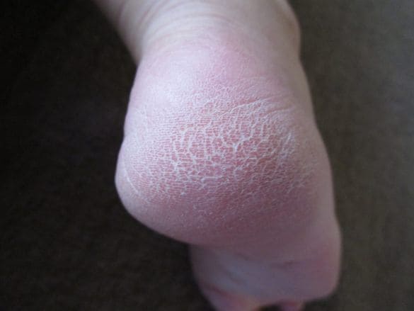  写真はイメージです