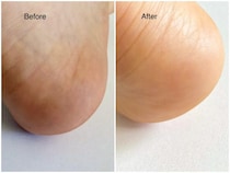 1回183円「ガサガサかかと用シートマスク」が効きすぎてたまげた！ 40代の私が、試してすぐ「2箱買い足した」ワケ