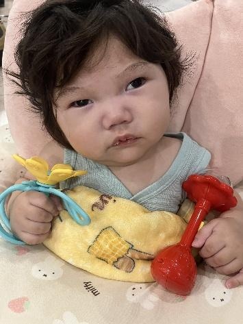  痰の吸引は欠かせない日々のケア