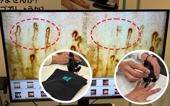  右）指先を計測器に入れたときの血流　左）メディヒールの布をかけたときの血流。素のままでは見えなかった血流が布をかけただけで活発化