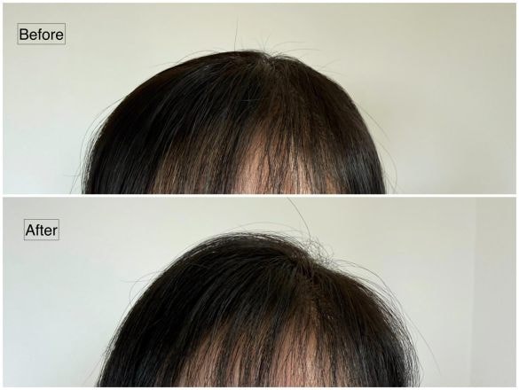 トップにボリュームがない