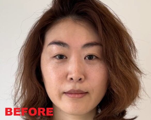  まぶたが垂れてきて、左右の目の大きさが変わってくることも