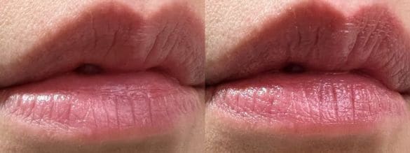  左：何も塗っていない状態、右：「薬用リップクリーム」を塗った状態