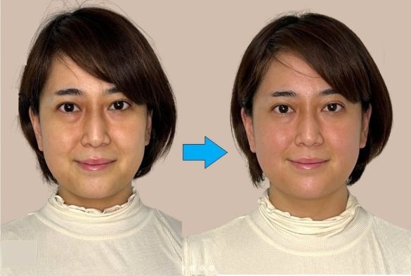 顔のくすみ・クマから不眠まで。コスメや薬に頼らない、“体の根本”に届く解決法とは?