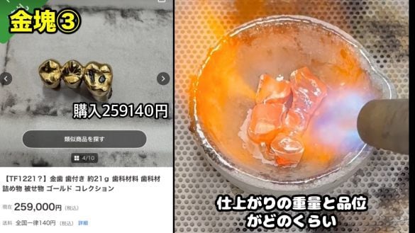  ヤフオクで購入した金歯